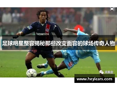 足球明星整容揭秘那些改变面容的球场传奇人物